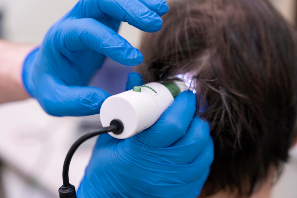 Best Hair Scalp Treatment in kochi